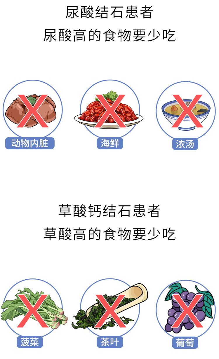 肾结石患者怎么补钙(肾结石病人补钙)-硒宝网