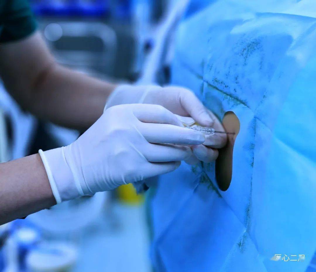 补硒会有头晕手麻木（头晕麻木补手硒会有效果吗）-硒宝网