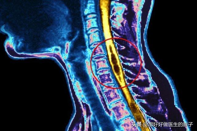 补硒会有头晕手麻木（头晕麻木补手硒会有效果吗）-硒宝网