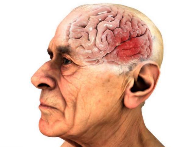 女性补硒钙片有哪些(补女性钙片硒有副作用吗)-硒宝网