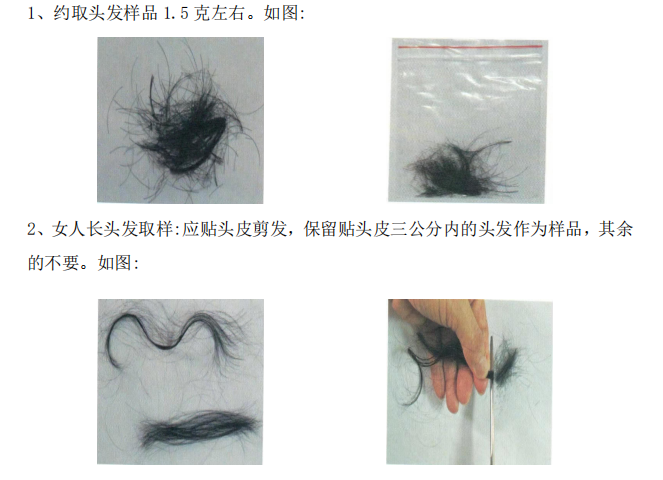 微量元素检查是抽血吗（微量元素抽血检查是抽血吗）-硒宝网