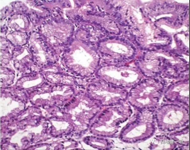 hpv补硒有效果吗(补硒可以治疗hpv阳性吗)-硒宝网