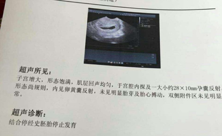 孕期补锌硒补到几周(孕妇补充锌硒的好处)-硒宝网