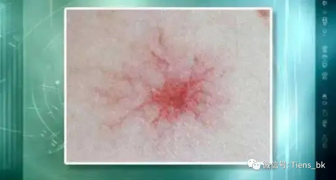 补硒迅速解除视疲劳(视疲劳的药物)-硒宝网