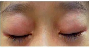 补铁计算公式（补铁的公式）-硒宝网