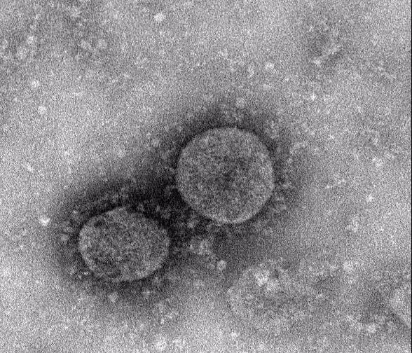 疫情期间教授说补硒(国家对疫情期间补贴的政策)-硒宝网