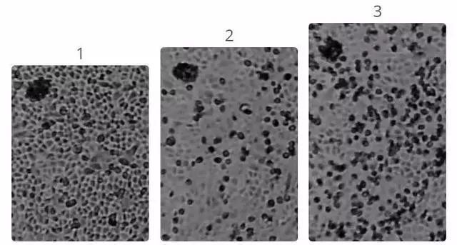 疫情期间教授说补硒(国家对疫情期间补贴的政策)-硒宝网