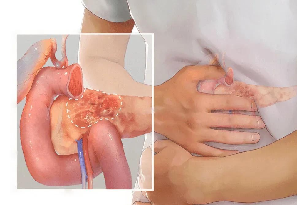 补硒之后大便次数多(刘延宁科学补硒健康中国)-硒宝网