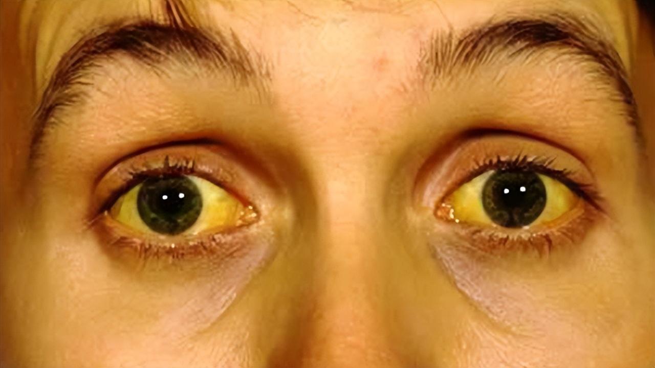 补硒之后大便次数多(刘延宁科学补硒健康中国)-硒宝网