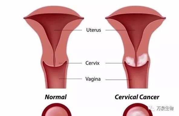 补硒多了会有湿疹吗(湿疹补硒会有副作用吗)-硒宝网