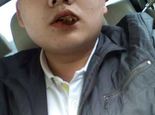 口腔白斑可以补硒吗（硒与白斑）-硒宝网