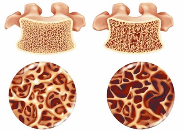 中年男性补钙吃什么钙片好(中年男性补钙吃什么)-硒宝网