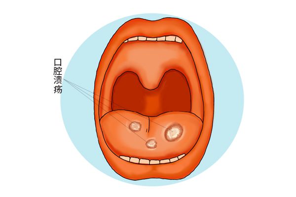 补钙上火是什么原因（原因上火补钙是补什么的）-硒宝网