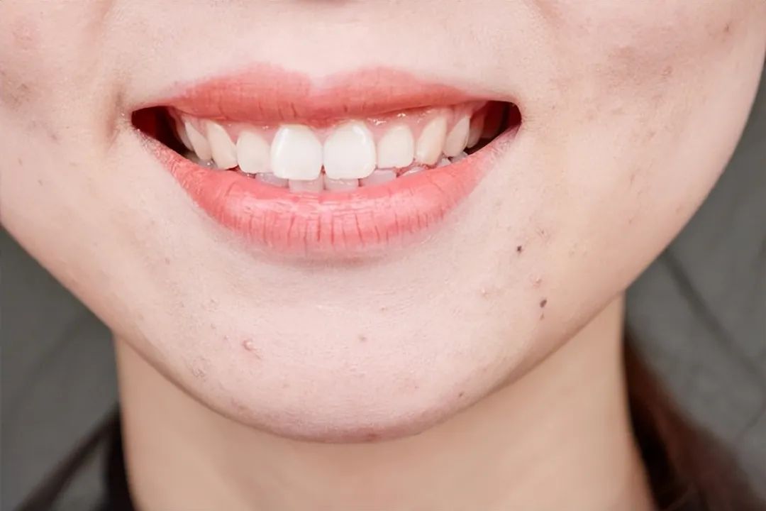 睡前补钙好吗（补钙睡觉前吃补钙好吗）-硒宝网