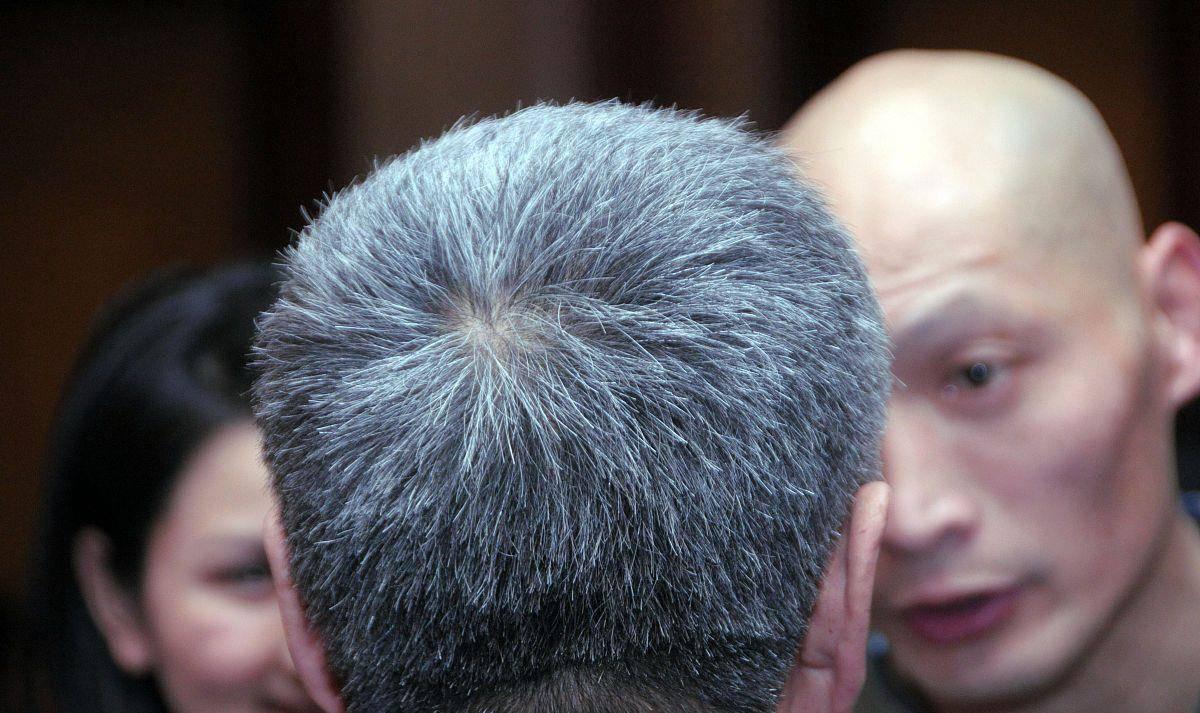 补硒可以治疗白发吗(硒白发)-硒宝网