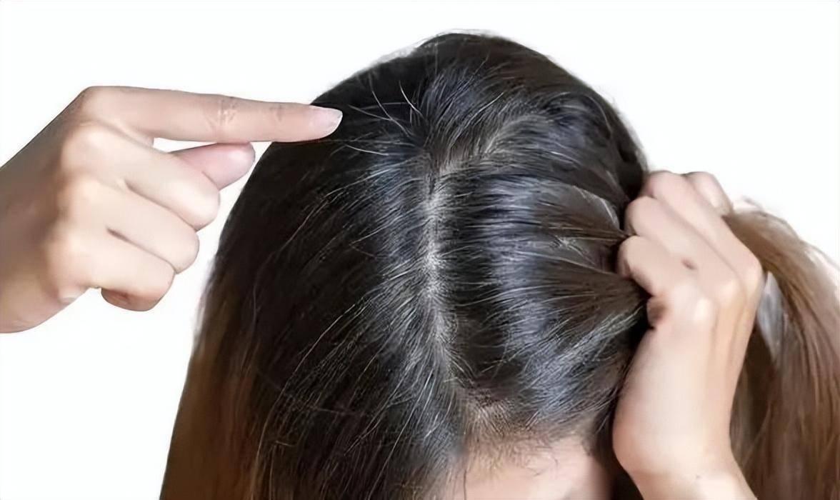 补硒可以治疗白发吗(硒白发)-硒宝网