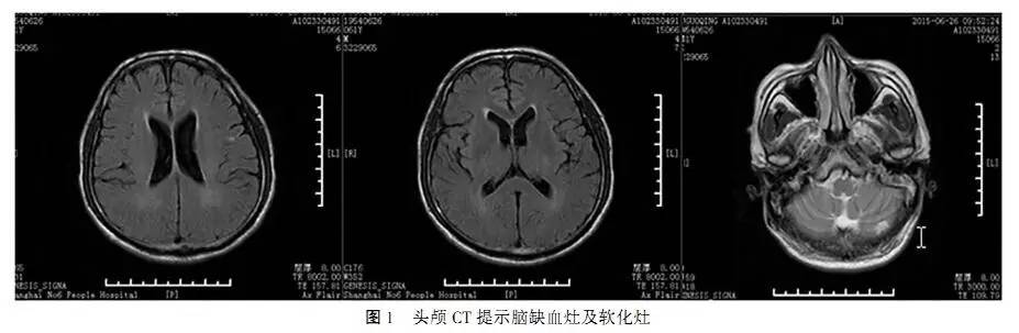 盐胶囊补钠口服用量(胶囊装盐补钠)-硒宝网