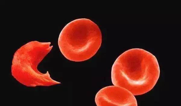 贫血可以补铁吗(贫血补铁可以吗)-硒宝网