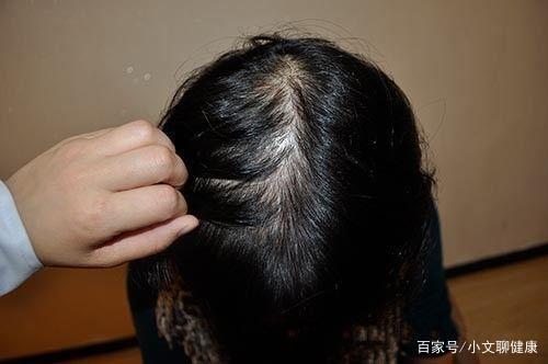 贫血可以补铁吗(贫血补铁可以吗)-硒宝网