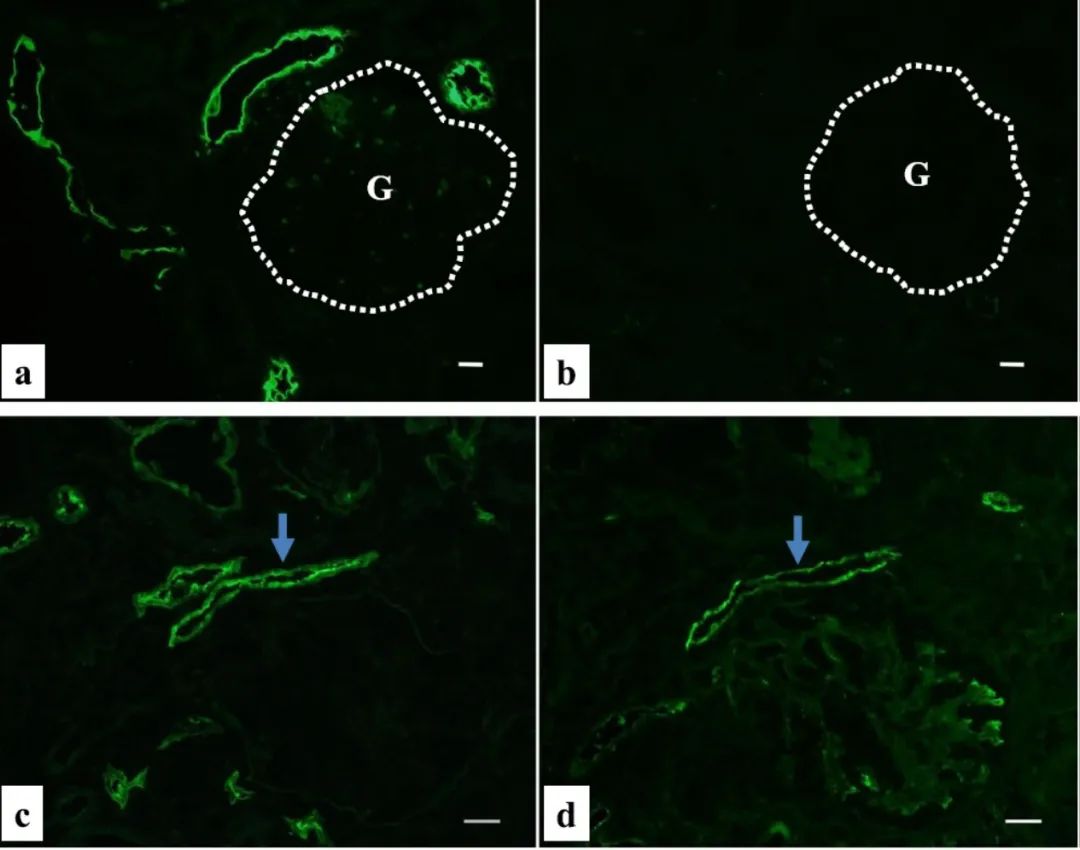 贫血可以补铁吗(贫血补铁可以吗)-硒宝网