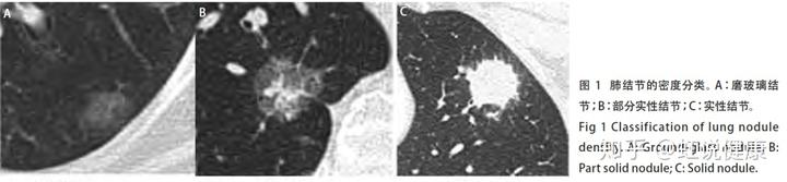 补硒可以治好肺结节(肺结节可以吃硒酵母片吗)-硒宝网