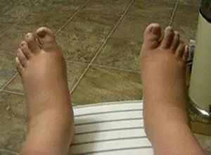 土地缺硒可以怎么补（硒不缺可以补吗）-硒宝网