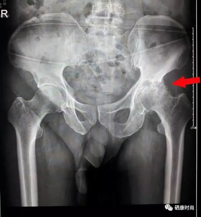 儿童硒元素低怎么补（小孩硒低了会怎样）-硒宝网