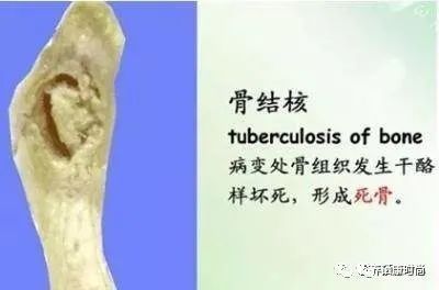 儿童硒元素低怎么补（小孩硒低了会怎样）-硒宝网