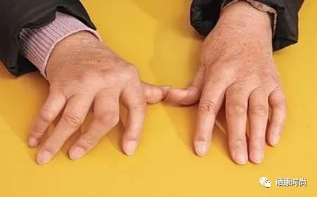 儿童硒元素低怎么补（小孩硒低了会怎样）-硒宝网