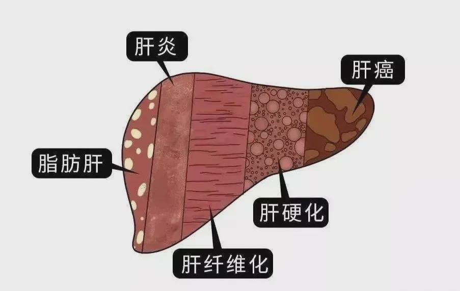 肝不好要补什么硒好（补硒治愈了我的肝病）-硒宝网