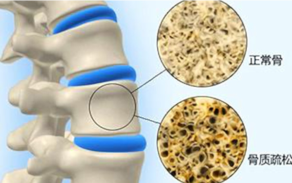 吃啥补钙最好最快（补钙吃好还是喝好）-硒宝网