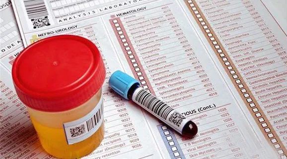 补硒会导致尿酸高吗(尿酸高可以吃硒元素吗)-硒宝网