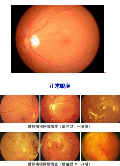 钠是微量元素吗（钠微量元素是指什么）-硒宝网