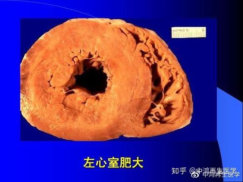 钠是微量元素吗（钠微量元素是指什么）-硒宝网