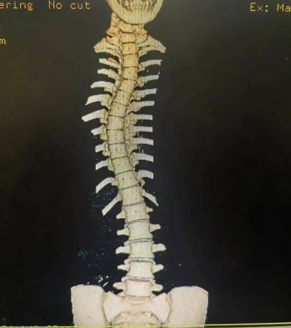 老年补钙（补钙老年人补钙最好吃什么）-硒宝网