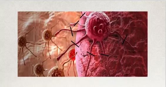 补硒治疗胆管癌用量(治疗胆管癌新药)-硒宝网