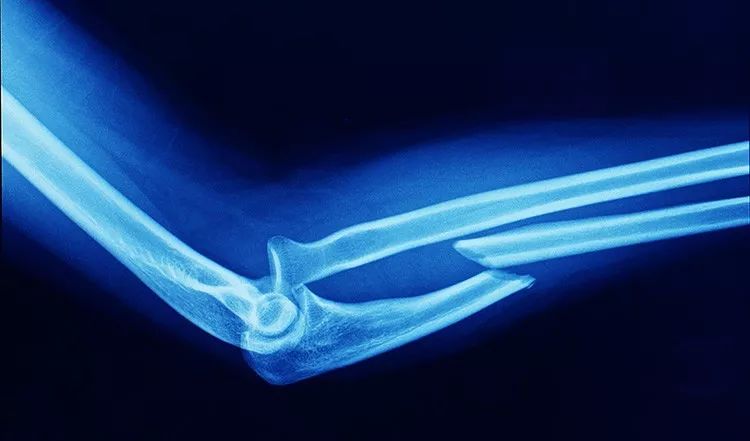 中老年人 补钙（补钙老年人中药有哪些）-硒宝网