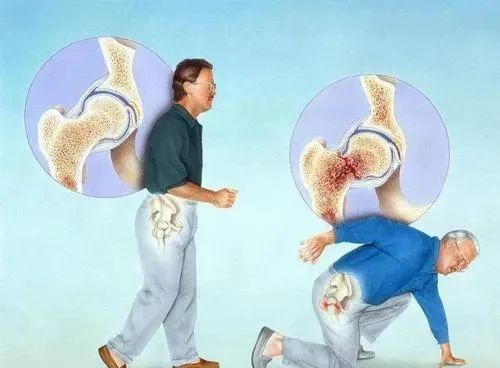 骨质疏松吃什么补钙最好(骨质疏松吃那种钙)-硒宝网