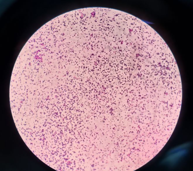 补铁的（补铁的水果）-硒宝网