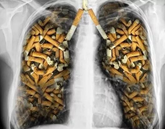 脑梗死补硒有益处吗(补硒后脑梗塞面积减少是真的吗)-硒宝网