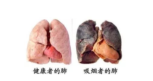 脑梗死补硒有益处吗(补硒后脑梗塞面积减少是真的吗)-硒宝网