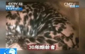 脑梗死补硒有益处吗(补硒后脑梗塞面积减少是真的吗)-硒宝网