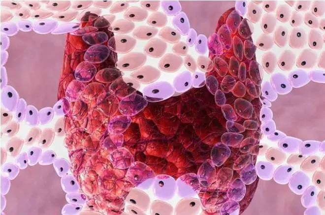 桥本甲减补硒的作用(补硒桥本)-硒宝网