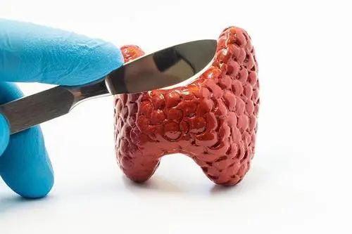 桥本甲减补硒的作用(补硒桥本)-硒宝网