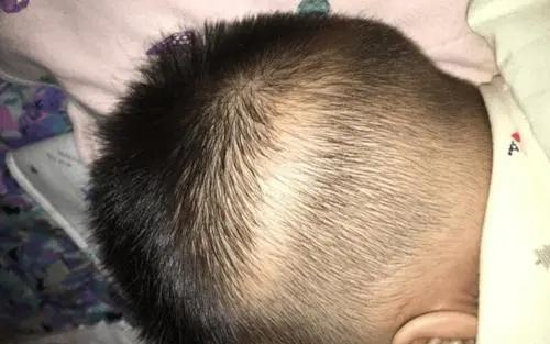 孩子补钙(补钙孩子吃什么好)-硒宝网