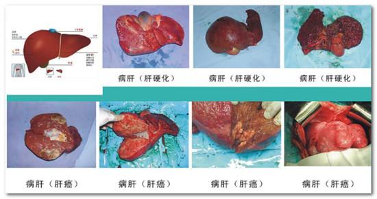 儿童肿瘤补硒保健品（肿瘤保健补儿童品硒有用吗）-硒宝网