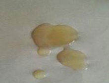 补锌补硒治疗不育症（补锌疗法）-硒宝网