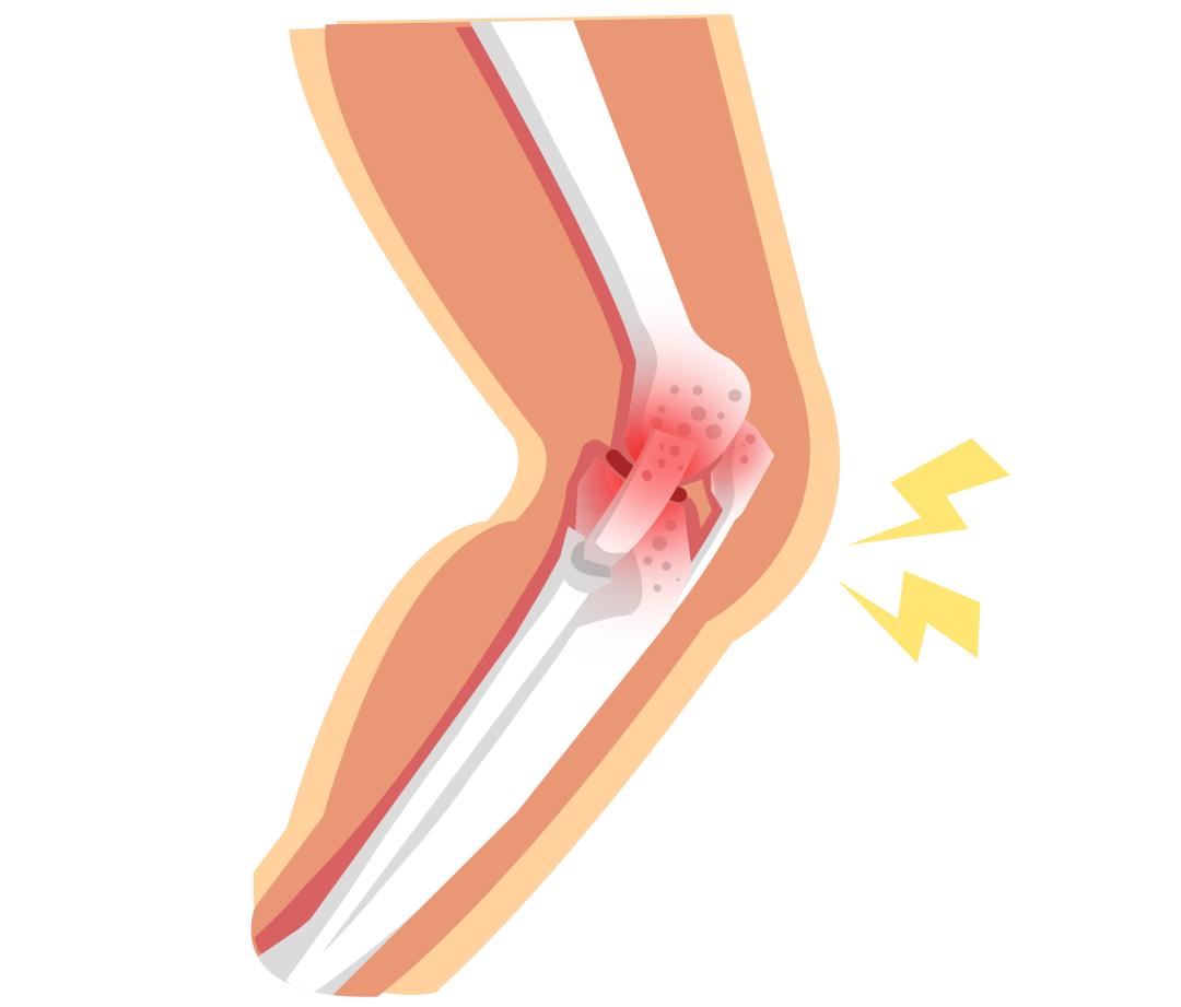 老人 补钙(补钙老人吃什么牛奶好)-硒宝网