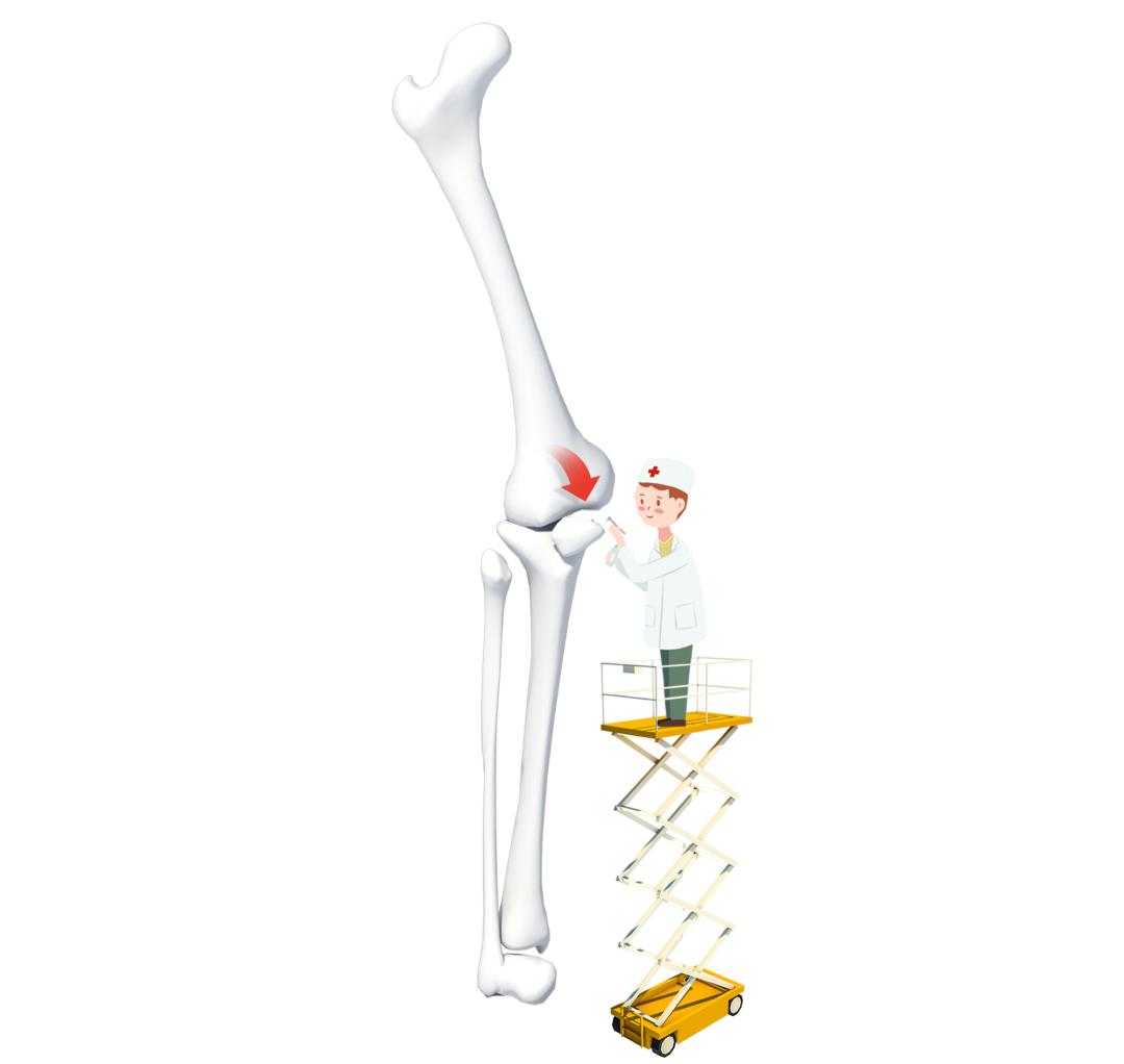 老人 补钙(补钙老人吃什么牛奶好)-硒宝网