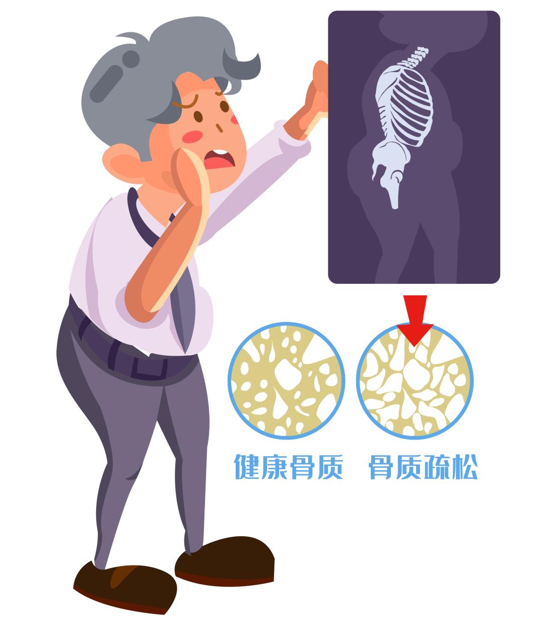 老人 补钙(补钙老人吃什么牛奶好)-硒宝网